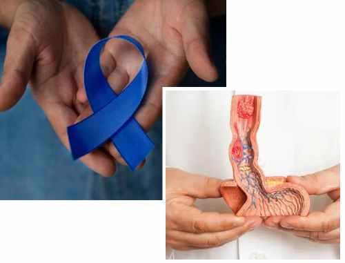 Causes of Penile Cancer