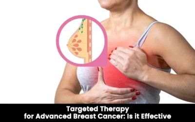 Targeted Therapy for Advanced Breast Cancer: Is it Effective