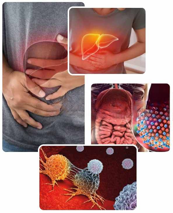 Liver Cancer Causes Liver Cancer Causes