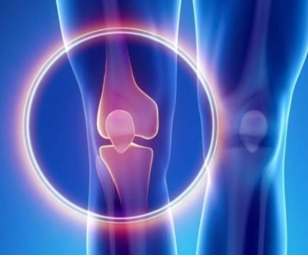 Osteosarcoma Osteosarcoma
