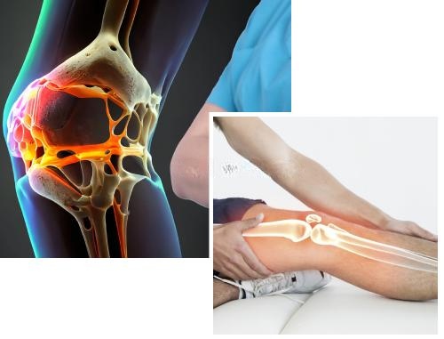 Causes of Bone Cancer Causes of Bone Cancer