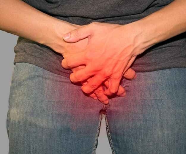 Penile Cancer<br />
