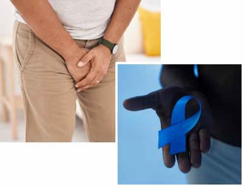 Stages of Penile Cancer