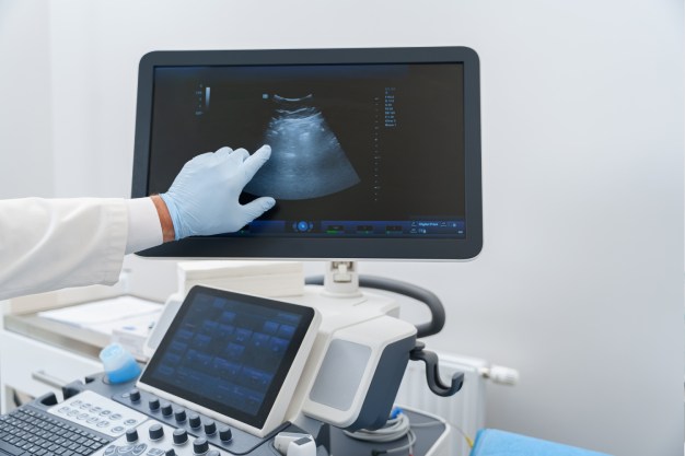 Imaging Tests of Gynaecological Cancer Imaging Tests of Gynaecological Cancer