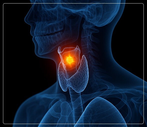 Types of Head and Neck Cancer Types of Head and Neck Cancer
