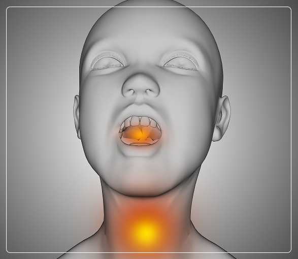 Stages of Oropharynx Cancer Stages of Oropharynx Cancer