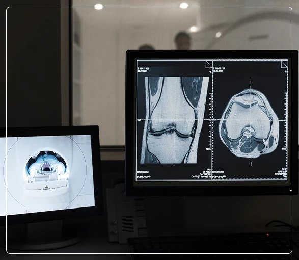 Diagnosis of Oropharynx Cancer Diagnosis of Oropharynx Cancer