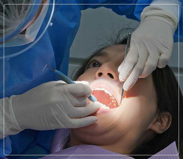Oral Cavity Cancer Diagnosis Oral Cavity Cancer Diagnosis