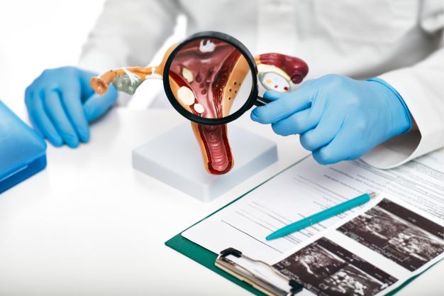Ovarian Cancer Causes Reproductive History Ovarian Cancer Causes Reproductive History