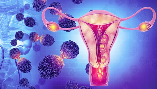Gynecologic Cancer | Dr. Joydeep Ghosh