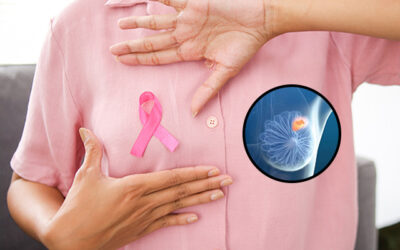 Found a Breast Lump? 10 Warning Signs It Could Be Breast Cancer